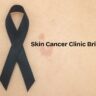 skin cancer image