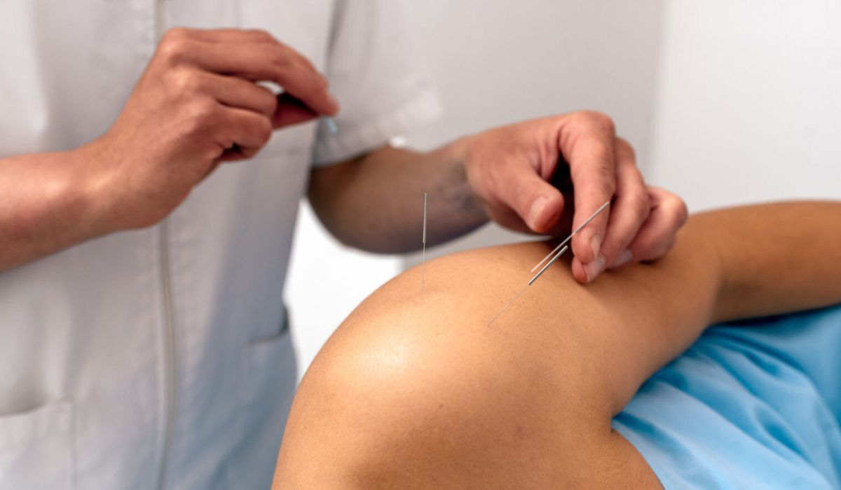 Dry Needling image