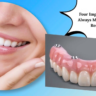 Four Implants image